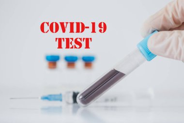 Pozitif Covid-19 testi. Coronavius salgını krizi. Laboratuvarda bir tüpte kan örneği.. 