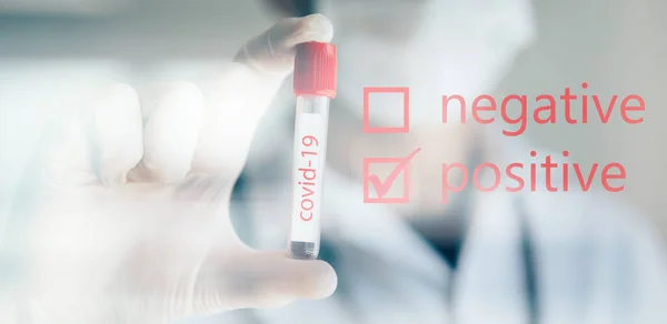 Doktorun Covid-19 testi pozitif çıktı. Coronavius salgını krizi. Laboratuvarda bir tüpte kan örneği.. 