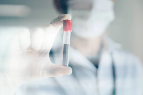 Doktorun Covid-19 testi pozitif çıktı. Coronavius salgını krizi. Laboratuvarda bir tüpte kan örneği.. 