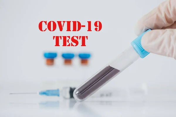 Pozitivní Covid Test Coronaviova Krize Propuknutí Vzorek Krve Zkumavce Laboratoři — Stock fotografie