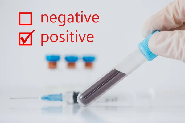 Positive Covid Test Coronavius Outbreak Crisis Blood Sample Tube Lab — Stock Photo, Image