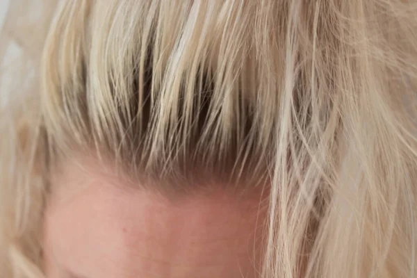 別々の髪の成長した根を持つ女性のブロンドの頭の閉鎖 ヘアケア 新しいヘアドアを作る ヘアセラピーの概念 — ストック写真