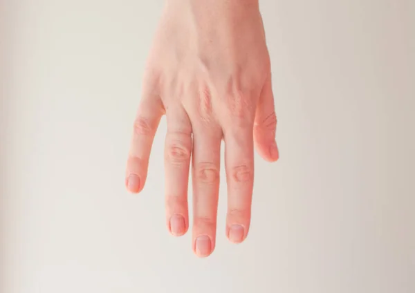 Ett Spår Från Vigselringen Ringfingret Kvinnlig Hand Visar Spår Förlovningsringen — Stockfoto