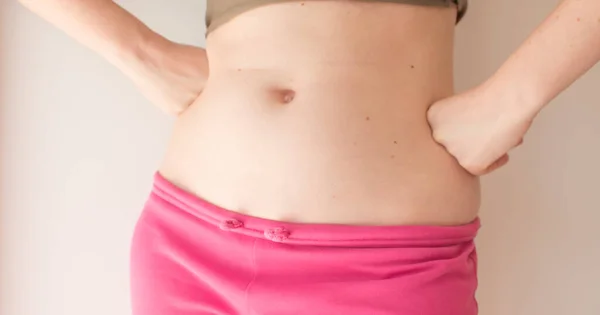 Eine Junge Frau Zeigt Muttermale Auf Ihrem Bauch Geburtstagskonzept — Stockfoto