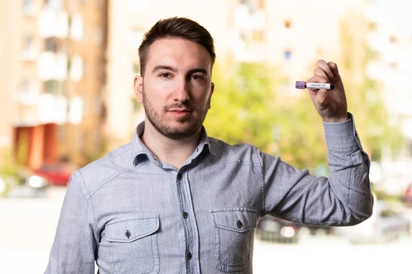 Junger Mann Ohne Chirurgenmaske Und Handschuhe Mit Einem Blutteströhrchen Das — Stockfoto