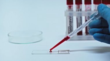 Bilim adamının laboratuvar camına pipetle kan damlaları eklediği görüntüler.