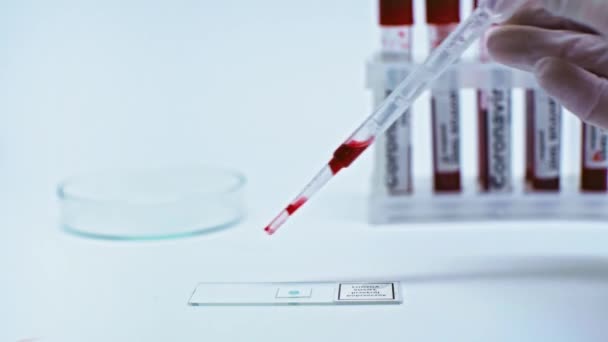 Καλλιεργημένη Άποψη Του Επιστήμονα Προσθέτοντας Δείγμα Αίματος Coronavirus Εργαστηριακό Γυαλί — Αρχείο Βίντεο