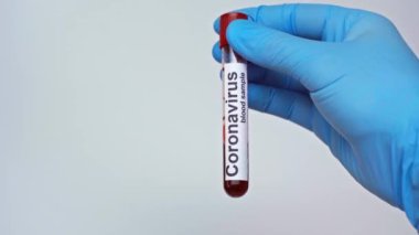 Coronavirus test tüpü olan doktorun elleri baş parmağın gri renkte olduğunu gösteriyor.