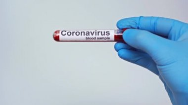 Doktorun Coronavirus test tüpünü gri renkte tutarken çekilmiş görüntüsü.