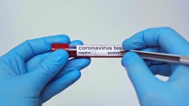 Doktorun pozitif koronavirüs testi gri renkte izole edildi.
