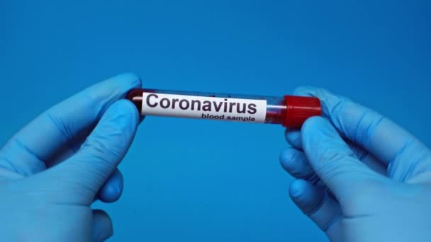 Teilansicht Des Arztes Zeigt Coronavirus Reagenzglas Isoliert Blau — Stockvideo