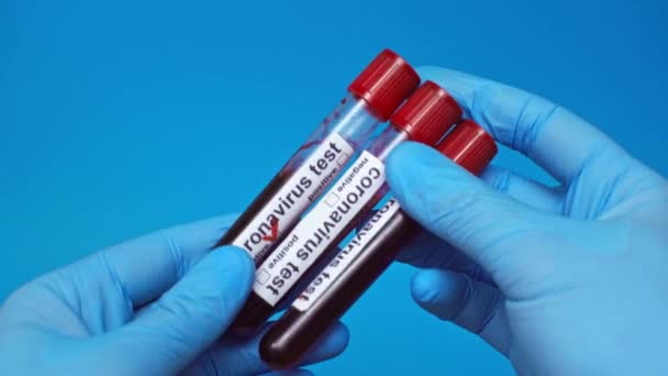 Visão Parcial Médico Mostrando Coronavírus Testes Tubos Isolados Azul — Vídeo de Stock