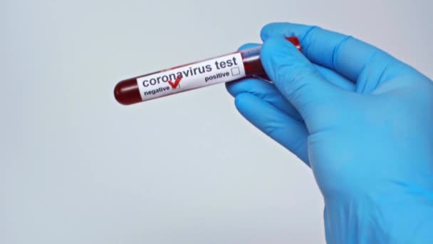 Partial View Doctor Holding Negative Coronavirus Test Isolated Grey — Stock Video