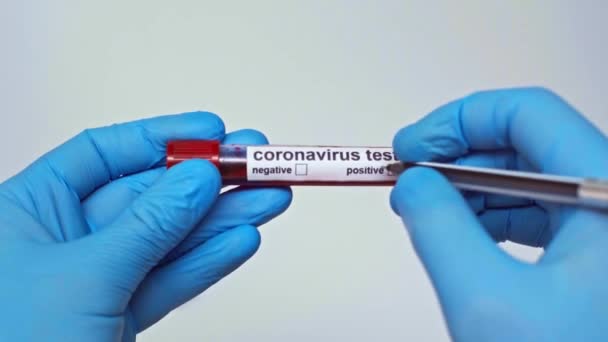 灰色で隔離されたポジティブコロナウイルス検査をマーキングする医師のクロップドビュー — ストック動画