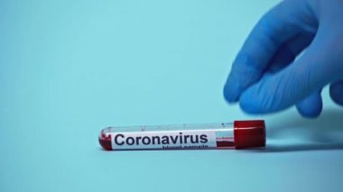 Doktorun mavi harflerle Coronavirus yazısıyla test tüpü alışını izledik. 