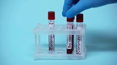 Doktorun mavi üzerine koronavirüs yazısıyla test tüpleri yerleştirdiği görüntüler. 