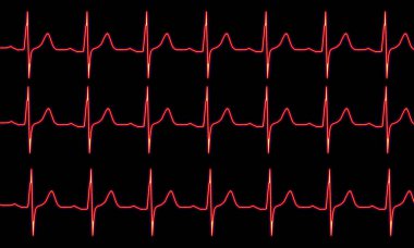 Siyah arka planda kırmızı kardiyogram nabız izi, kardiyovasküler muayene. Sağlıklı kalp konsepti. Tıbbi geçmiş