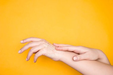 Hands with dry cracked skin, the concept of hand skin problems. Yellow background clipart