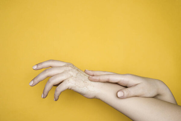 Руки с сухой потрескавшейся кожей, концепция проблем с кожей рук. Желтый фон
