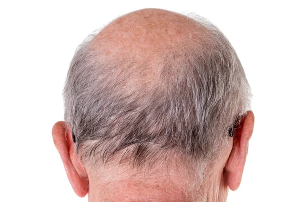 Parte de trás da cabeça careca do velho . — Fotografia de Stock