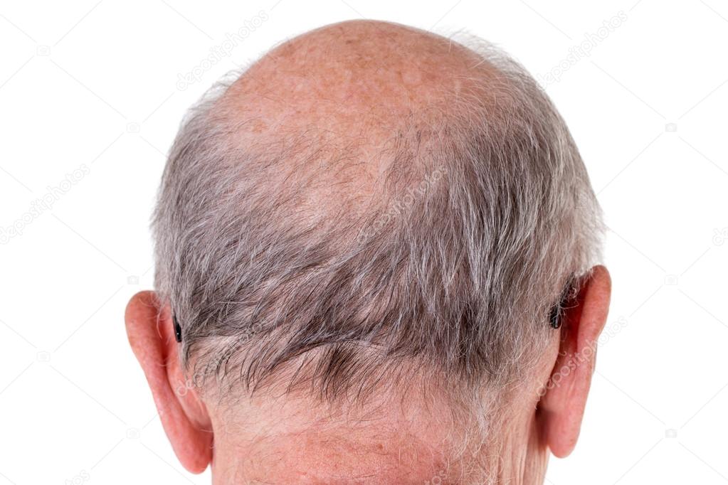 Back Of The Bald Head Of Old Man — Stock Photo © Indigolotos 128245954