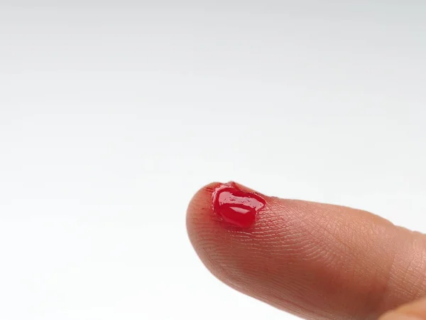 Male Toe Torn Bleeding Skin Personal Injury First Aid — Stock Photo, Image