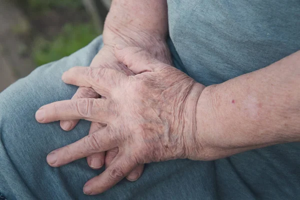 Las manos de una anciana sobre su rodilla —  Fotos de Stock