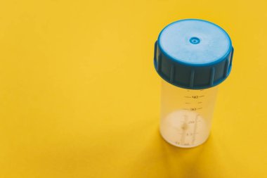 Sarı arka planda mavi kapaklı tıbbi testler için örnek konteynır. Klinik analiz