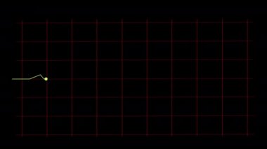 Karanlık monitörde bir elektrokardiyogramın görüntüsü. Karanlık monitörde ışık titreşimi var. Animasyon filmi elektrokardiyogramı.