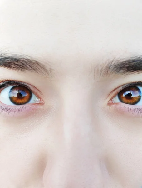 Louco Olhar Maluco Homem Com Olhos Tortos — Fotografia de Stock
