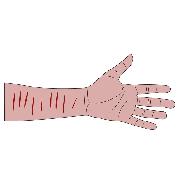 Mužská ruka s krvavými ranami na zápěstí po pokusu o sebevraždu. izolovaná kreslená kreslená vektorová ilustrace — Stockový vektor