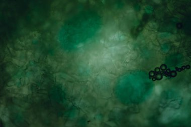 Soyut yeşil arkaplan. Sıvıdaki parçacıklar. Mikroskop altında görüntüle.