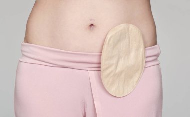colostomy pouch attached to patient - image clipart
