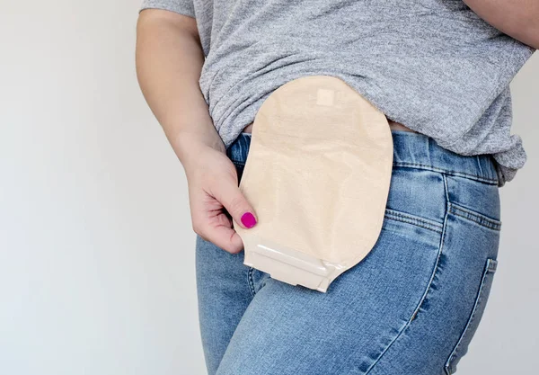 Vista frontal de la bolsa de colostomía en color de piel adherida al paciente —  Fotos de Stock