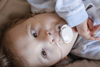 Baby boy with cerebral palsy is getting oxygen via nasal prongs 