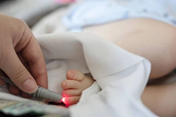 Doctor performs laser therapy on the baby patients toe — Stock Photo, Image