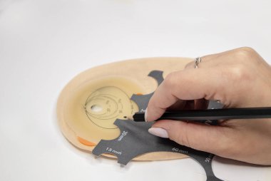 Kolostomi torbasının üst görüntüsü, kolostomi ameliyatından sonra gerekli malzemeler - kolon kanseri tedavisi. Deri rengi filtreli ostomi torbası. Tıbbi tema. Stoma çantası.