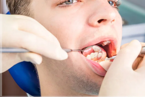 Сучасної стоматології процес . — стокове фото