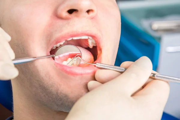 Bliska dentysta sprawdzanie. Otwórz usta. — Zdjęcie stockowe