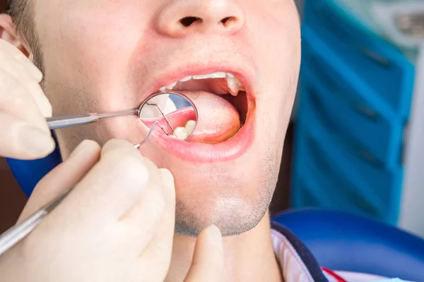 Dentist close up checking. Young man in dental chair. of or relating to the teeth — Stock Photo, Image