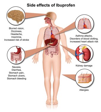 Beyaz arkaplan üzerinde ibuprofen 3d tıbbi vektör illüstrasyonunun yan etkileri