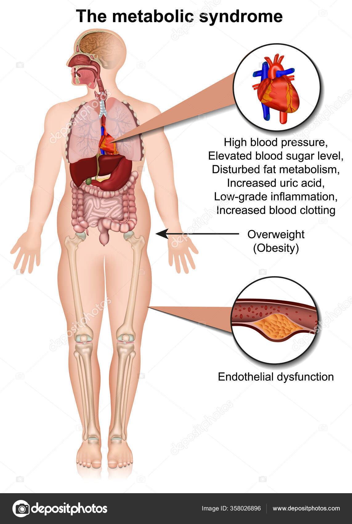 Metabolic System Medical Vector Illustration Isolated White Background Infographic Eps Stock Vector Image by ©medicalstocks #358026896 Metabolic System Medical Vector Illustration Isolated White Background Infographic Eps Stock Vector Image by ©medicalstocks #358026896