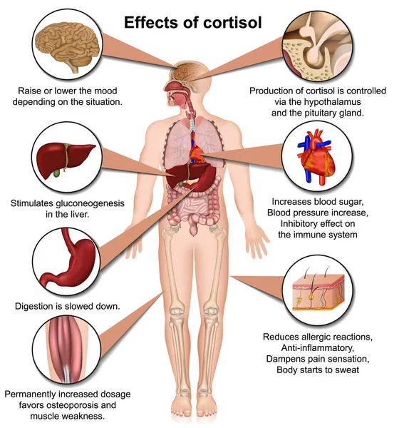 Efectos Del Cortisol Cuerpo Humano Vector Médico Ilustración Aislada Sobre — Vector de stock