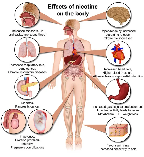 Efectos Nicotina Cuerpo Vector Médico Ilustración Infografía Aislada Sobre Fondo — Vector de stock