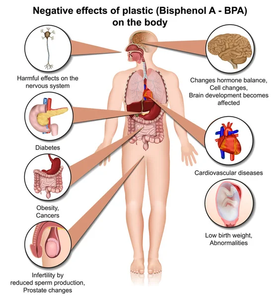 Bisfenol Efectos Sobre Cuerpo Humano Vector Médico Ilustración Aislada Sobre — Vector de stock