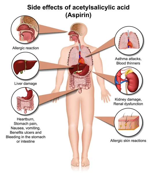 Aspirin Körpereffekte Medizinische Vektor Infografik Isoliert Auf Weißem Hintergrund lizenzfreie Stockillustrationen