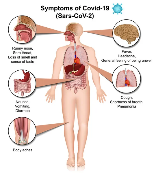 Symptome Von Covid Infografik Coronavirus Informationen Auf Weißem Hintergrund Isoliert Stockillustration