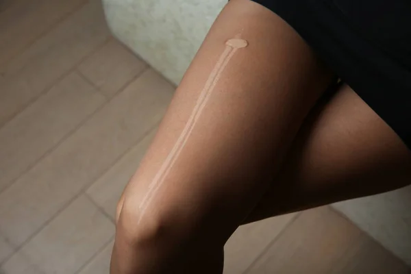 Bir Kadının Bacağında Külotlu Çorap Deliği Bacağında Yırtık Çoraplar — Stok fotoğraf
