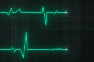 Parlak dijital kalp atışı hattı monitöre yansıyor, 3D görüntüleme.