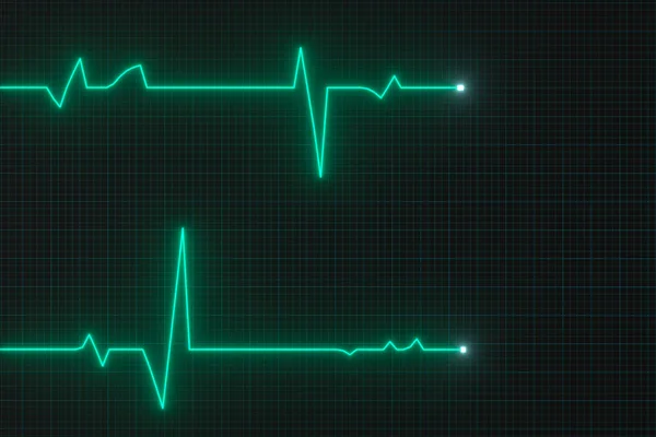 Glowing digital heartbeat line reflecting on the monitor, 3d rendering. — Stock Photo, Image